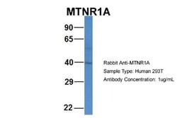 Melatonin R1A/MT1/MTNR1A Rabbit anti-Human, Polyclonal, Novus Biologicals 0.1 mL | Buy Online | Novus Biologicals | Fisher Scientific